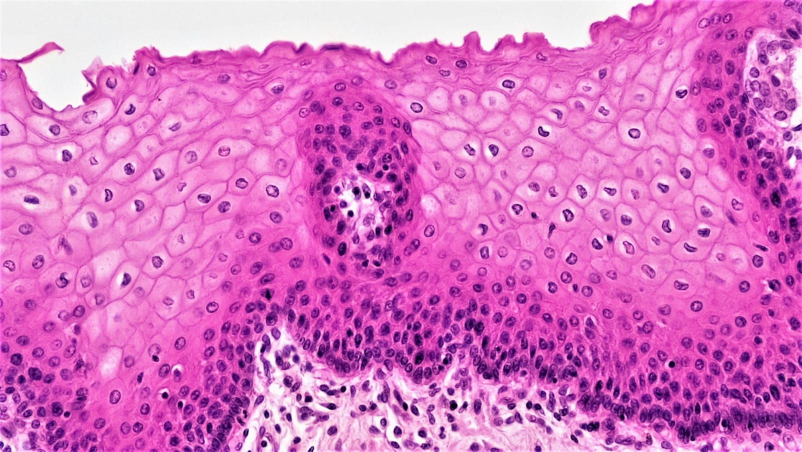 Epithelial Tissues: Stratified Squamous Epithelium